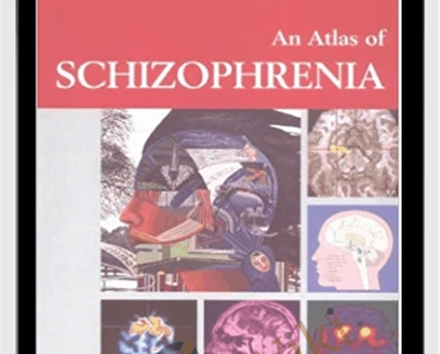 An Atlas of Schizophrenia - Encyclopedia of Visual Medicine Series - Martin Stefan